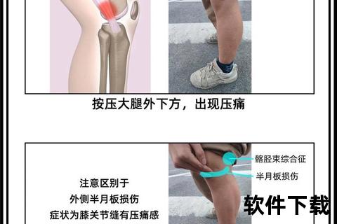 跑步膝哪里疼_详解膝外侧与髌骨下方痛点