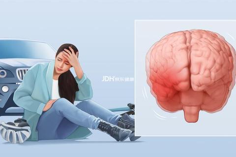 脑震荡致失忆：神经损伤与逆行性遗忘的关联机制  第2张