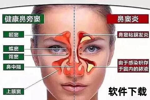 鼻炎患者跑步需谨慎：解析鼻腔健康与运动禁忌关联