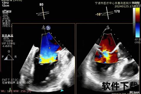 心臟實時影像解析_高清動態記錄與臨床應用新視界