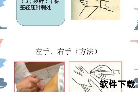 EPO注射方式解析：皮下与静脉操作要点