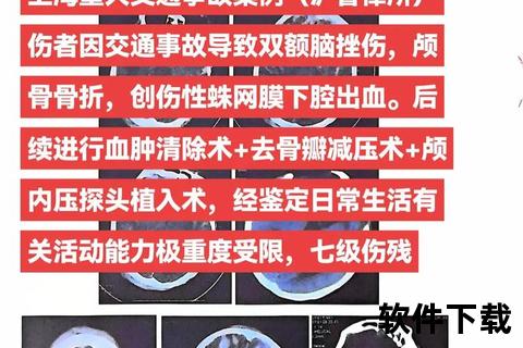 切赫的头盔之谜：颅骨重伤后的钢铁守护  第1张