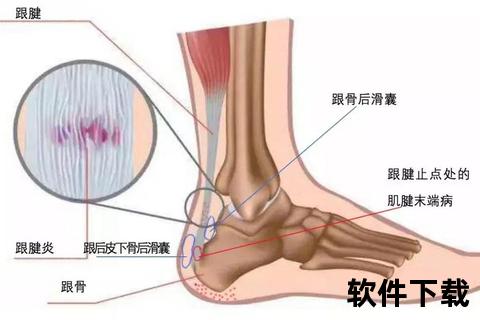 跟腱解析：人体关键肌腱的结构功能与损伤预防要点
