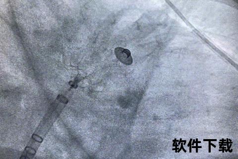 心臟實時影像解析_高清動態記錄與臨床應用新視界